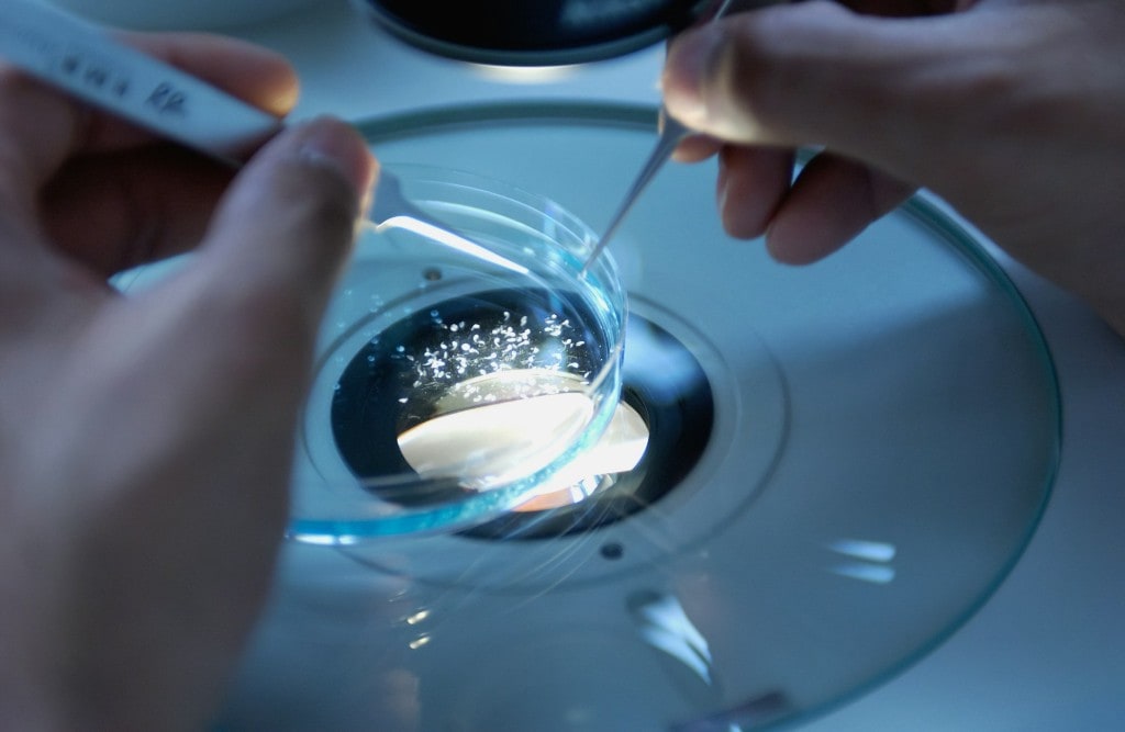 IVF